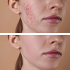DERMATOLOGICKÉ INFORMÁCIE!